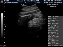 Vivian Sonograms